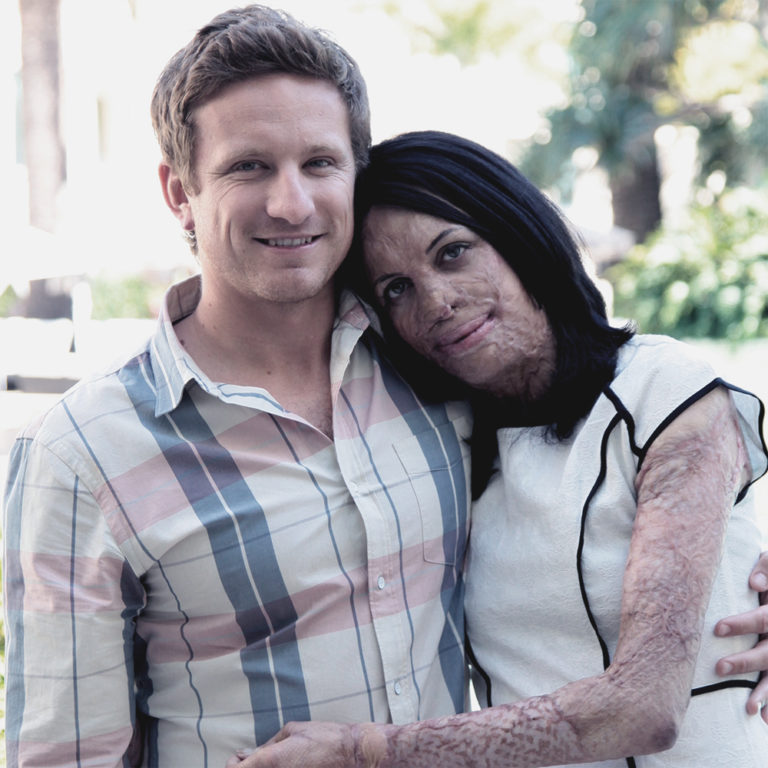 True Love: Ex-Model Turia Pitt